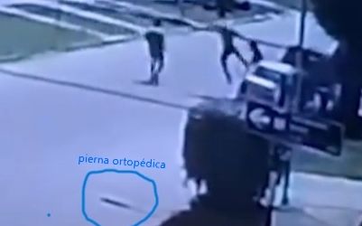 Motochorro con pierna ortopedica